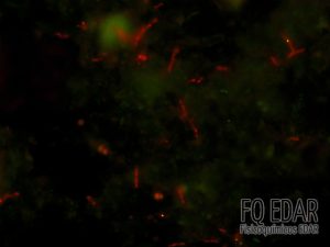 Determinación específica de bacterias en fangos activos mediante técnicas de última generación.